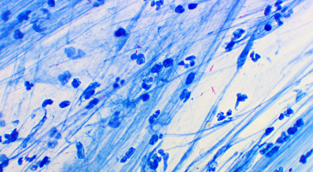 A color photo of Mycobacterium tuberculosis Credit: Shutterstock contributor Jarun Ontakrai