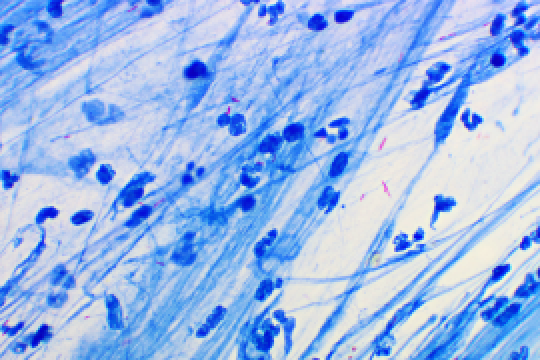 A color photo of Mycobacterium tuberculosis Credit: Shutterstock contributor Jarun Ontakrai